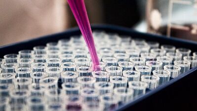 Comment faire des tests pour reconnaître les parasites dans le corps